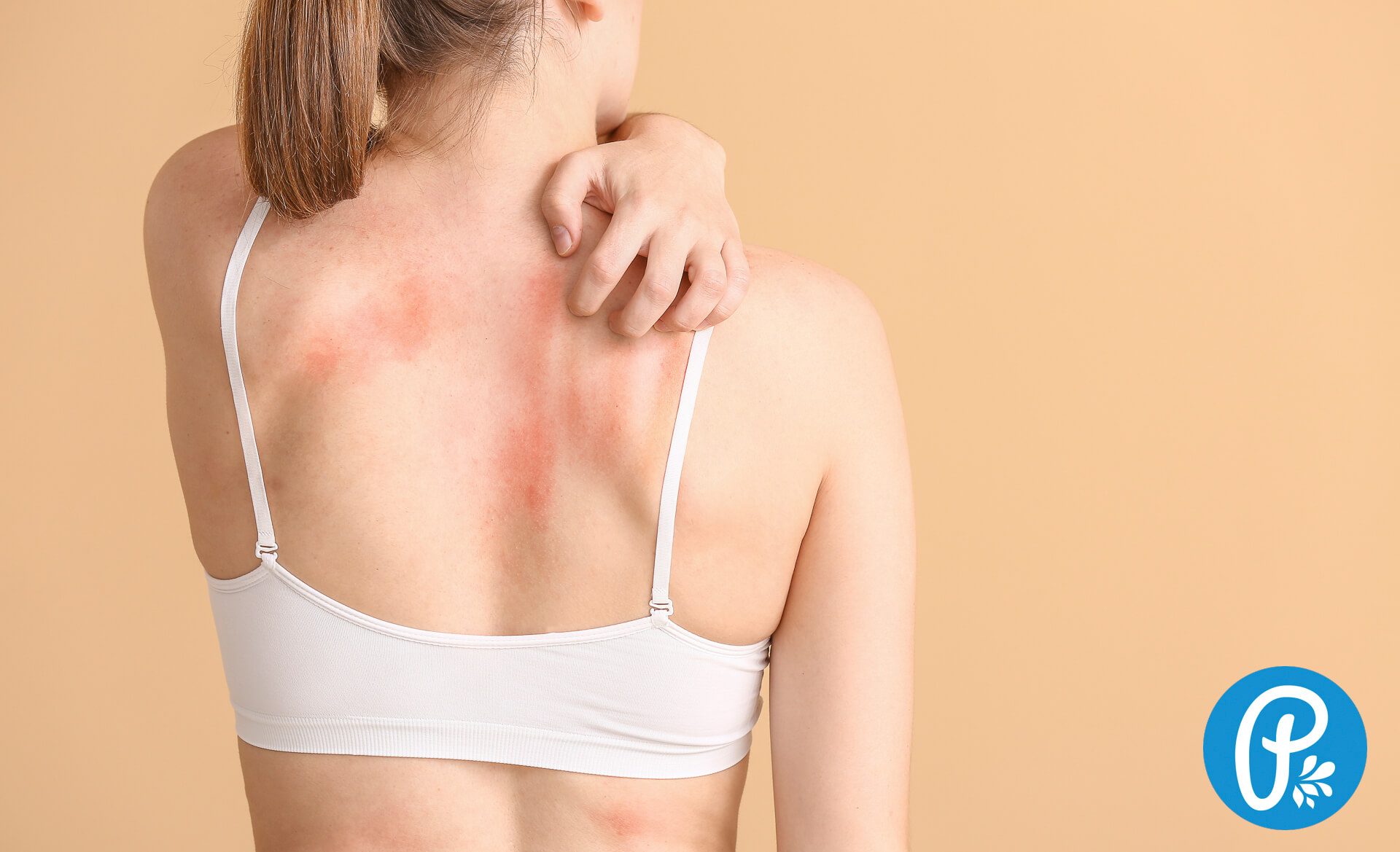 Svrbenie kože - ako sa ho zbaviť?