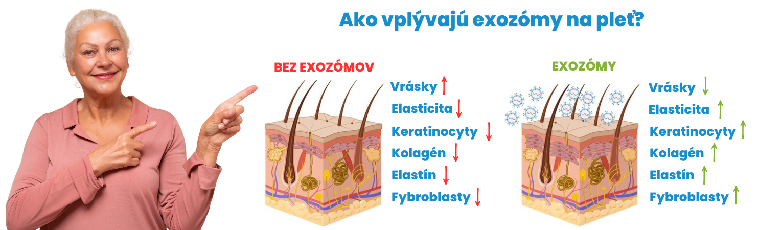 Exozomy