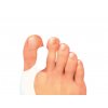hallux spreader