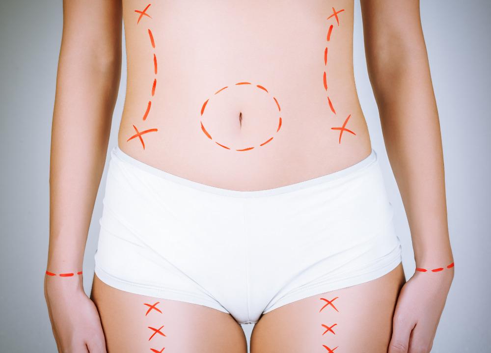 Zdraví na splátky - fenomén dneška