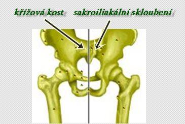Bolesti zad a kdy za ně může SI kloub (sakroiliakální kloub)