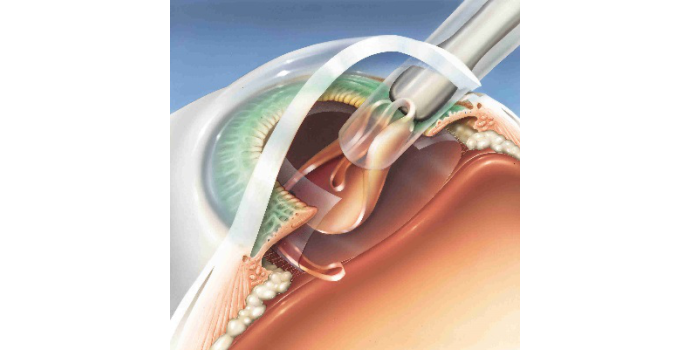 Člověk v „dílně“ medicíny: umělé orgány vracejí do života