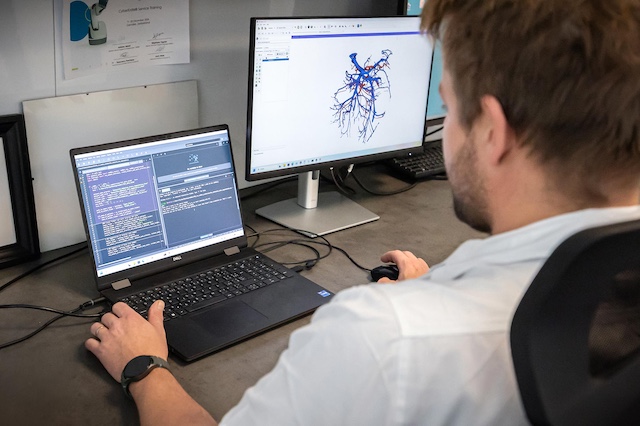 Výzkumníci FN Ostrava díky umělé inteligenci dokáží vizualizovat cévy tlustého střeva