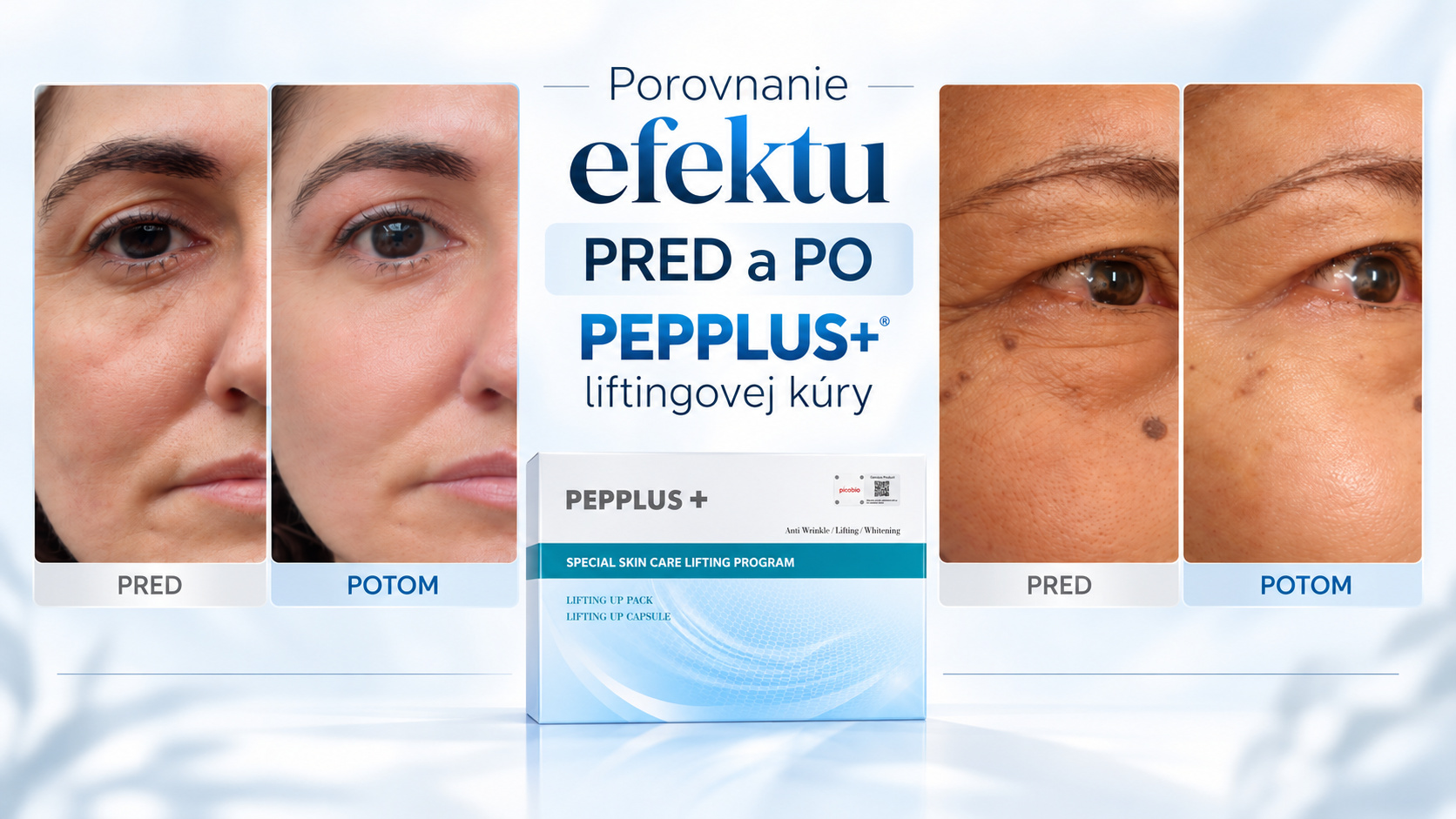 Porovnanie efektu pred a po PEPPLUS+ liftingovej kúre