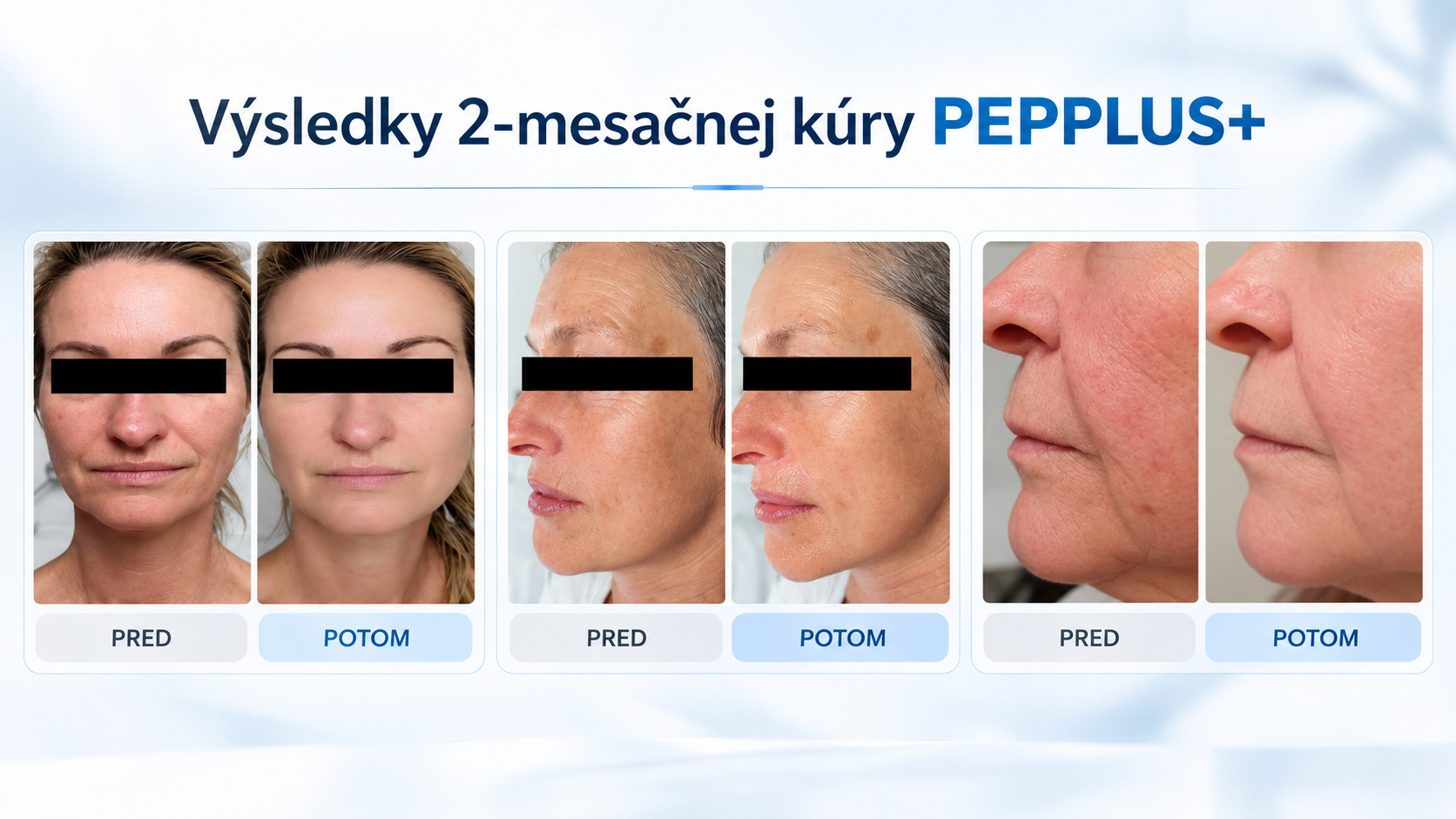 Výsledky 2-mesačnej kúry PEPPLUS+ pred a po
