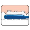 implantortho illustration 03