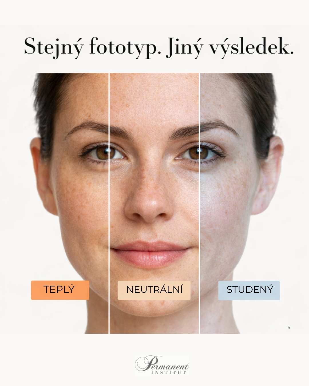 Fitzpatrickova škála v PMU: Proč ji znát, ale nespoléhat na ni.