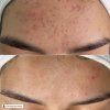 dsr acne elfriede bernhard 20250415 1 1920x1920