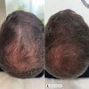 dsr hair 31307 simone brunelli 20240522 3 1920x1920