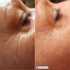 dsr anti aging eye mandi barnard 20200503 1 800x800
