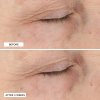 Essential Fx Rejuvenating Moisturizer B&A Sub18 1 2000x2000