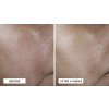 NoRinse Intensive Pore Minimizing Toner Composed B&A 1920x1080