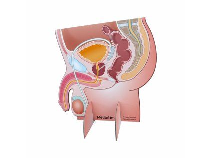 Prostata display 1