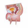 Prostata display 1