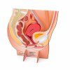 Pelvic display 1