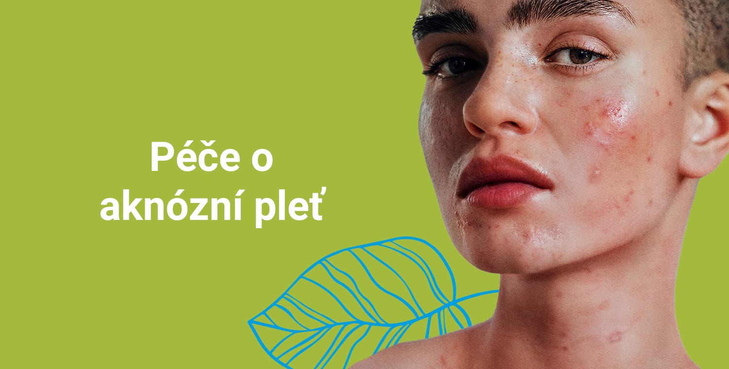 Péče o aknózni pleť