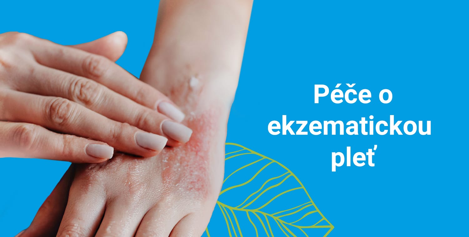 pece o ekzematickou plet