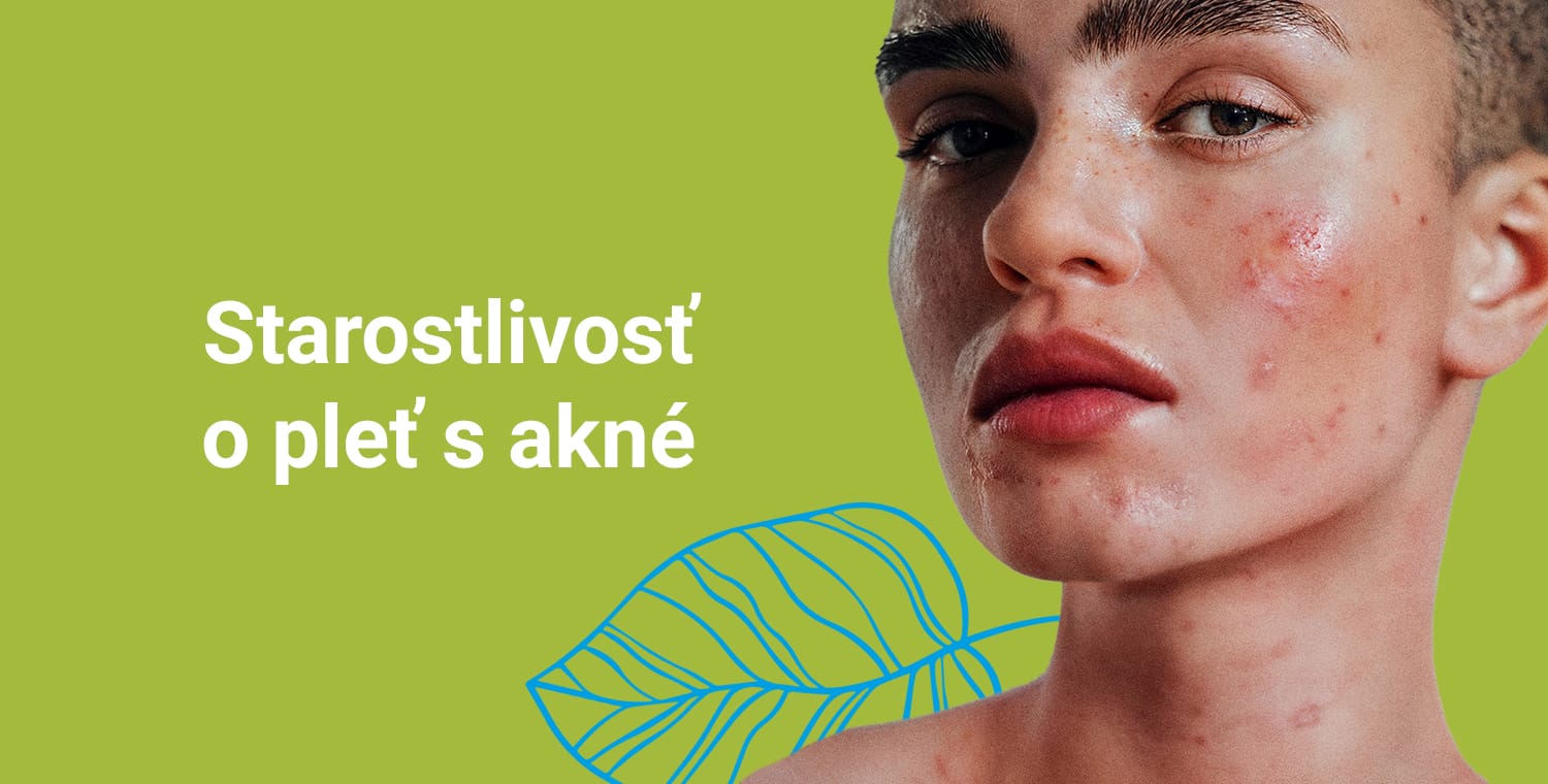 Starostlivosť o akné