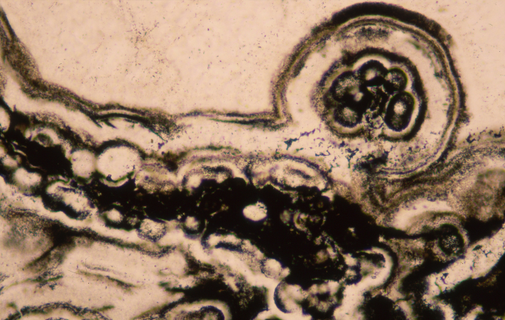 Mikroskopická fotografie