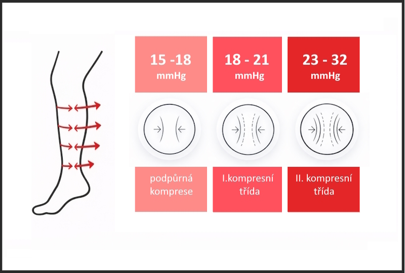 Přehled kompresních tříd punčoch