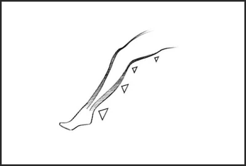 Jak komprese ovlivňuje žilní oběh