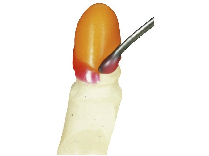 al dente Pro mod C krčkový vosk1