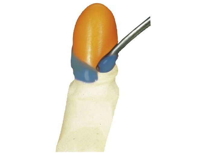 al dente Pro mod C krčkový vosk mod 1