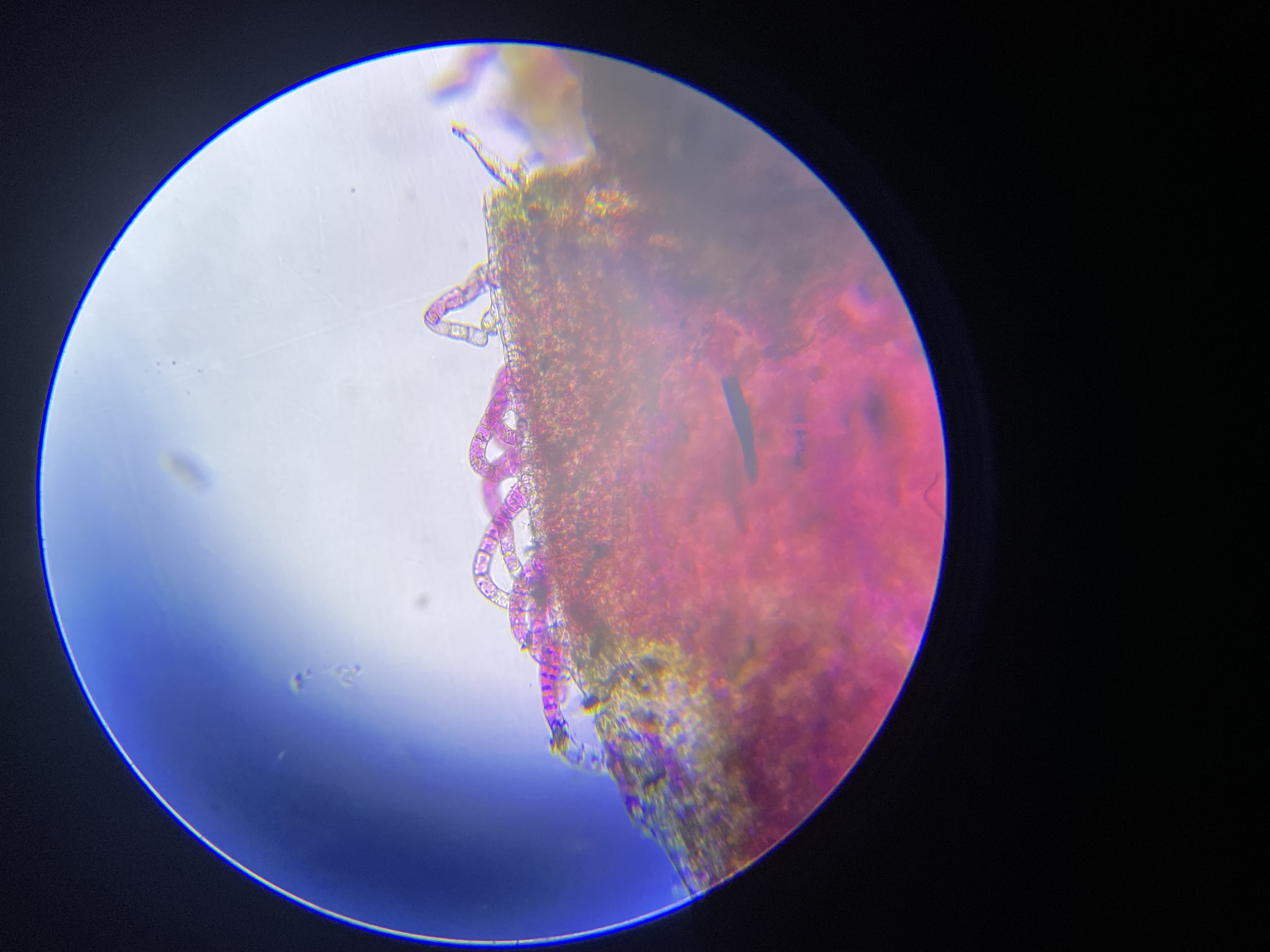 Chloroplasty