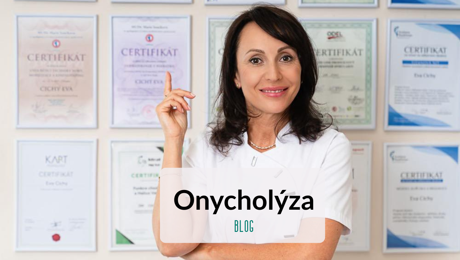 Onycholyza
