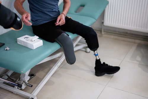 Rehabilitacja po amputacji kończyny dolnej