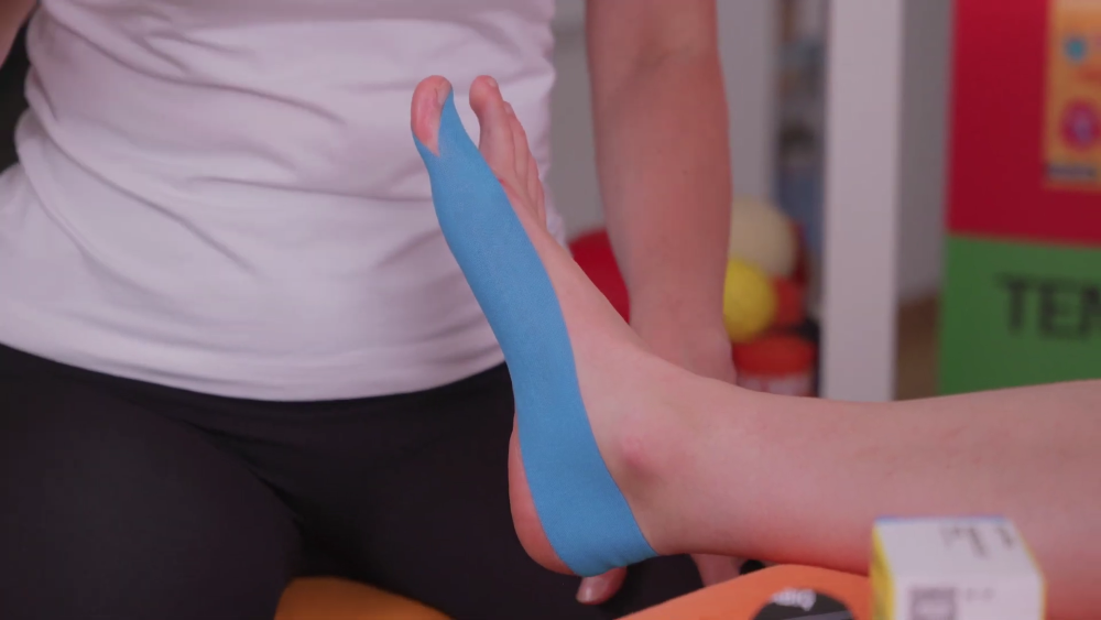 Jak zatejpować haluks (hallux valgus)