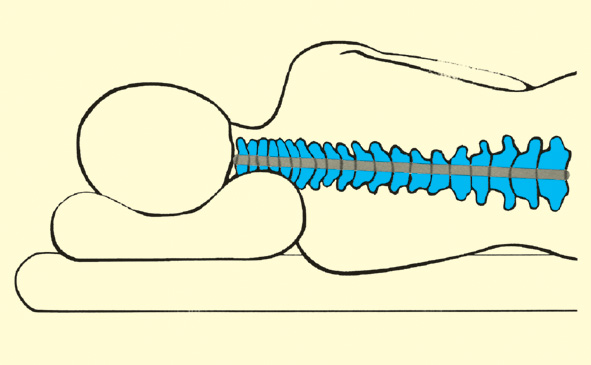 obliecka-na-ortopedicky-vankus-Mobilex-3