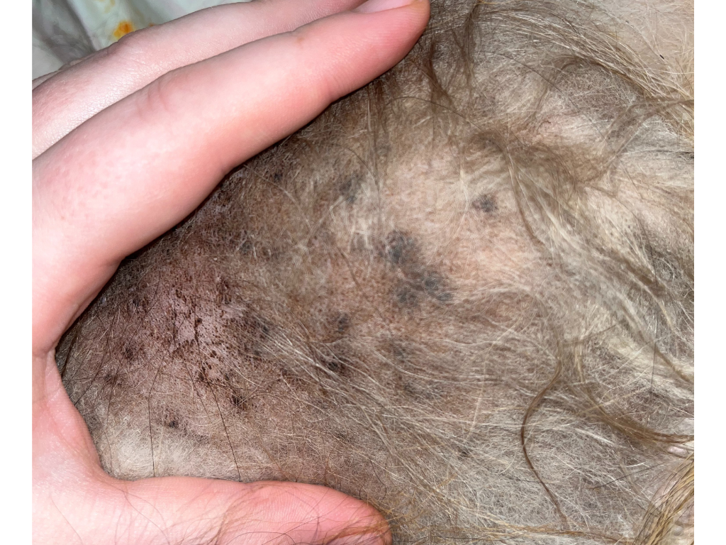 Zánět kůže kvasinky