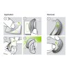 phonak stic n stay 3