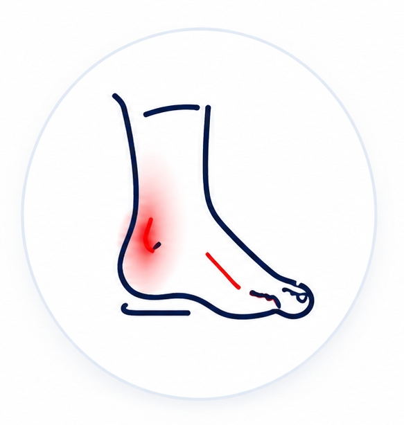 Vbočený palec – hallux valgus