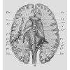 Qualia | Qualia Mind 2.0 - Qualia Life Sciences