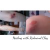 REDMOND CLAY - Hydratovaný bentonitový jíl k vnější aplikaci