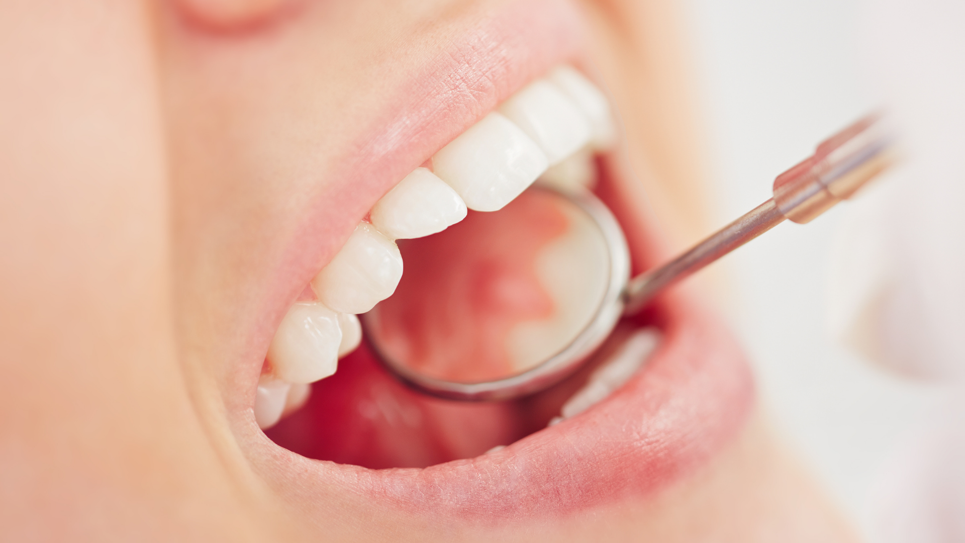 Problémy ústní dutiny