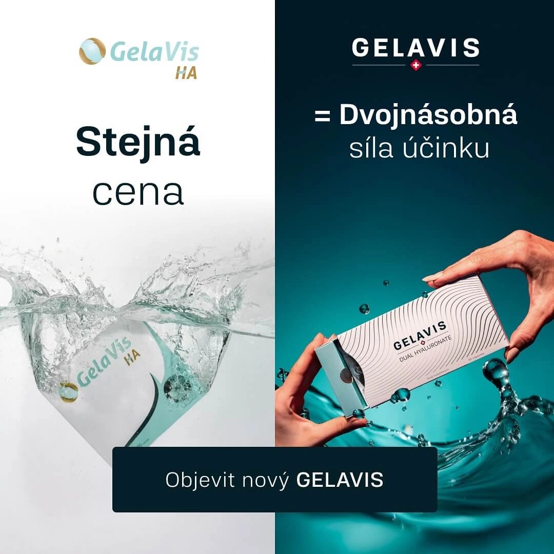 Kyselina hyaluronová