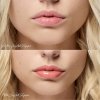 810170760206 LP09 CRYSTAL SLIPPER LIP OIL BEFORE AFTER 2000X2000