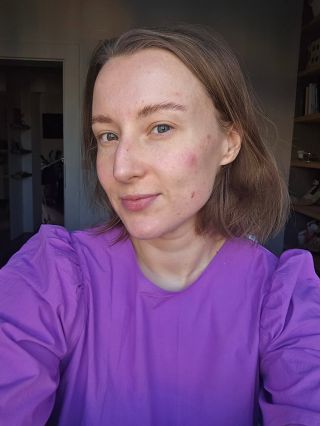 Tohle je moje pleť dnes. A já vím, že i tohle je to v pořádku. ❤️ Romana, která ti ještě před dvěma týdny sdílela fotku s...