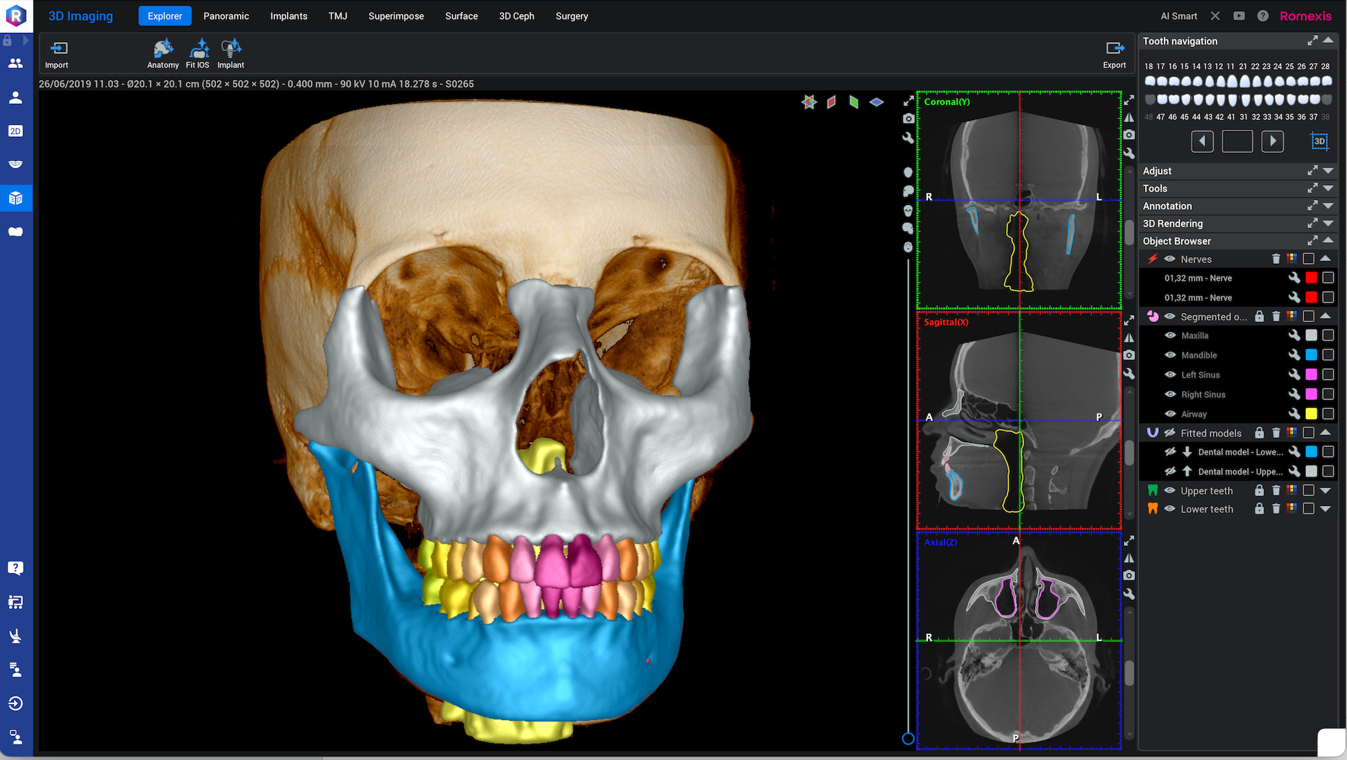 ROMEXIS 7 – NOVÁ ÉRA DIGITÁLNÍ STOMATOLOGIE S PODPOROU AI
