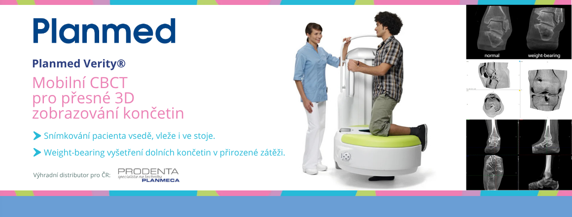 Planmed Verity - mobilní CT pro ortopedii