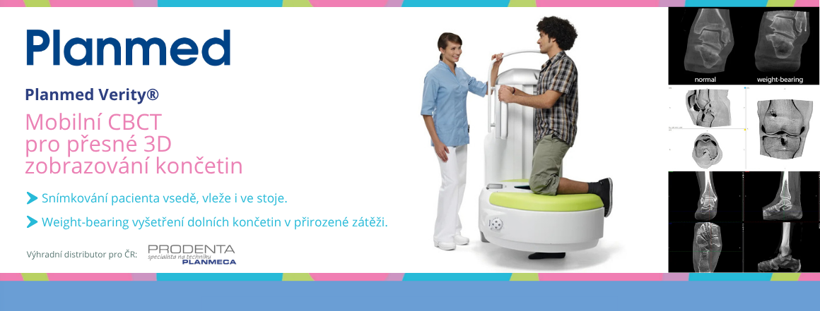 Planmed Verity - mobilní CT pro ortopedii