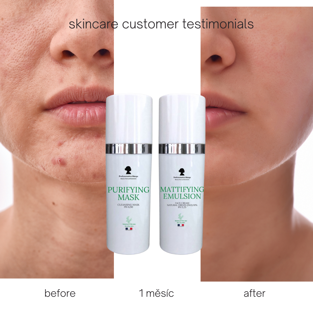 Mastná pleť pod kontrolou: Tajemství dokonalé rovnováhy a čistoty