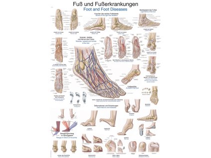 15226 1 plakat noha a nemoci nohou 70x100 cm