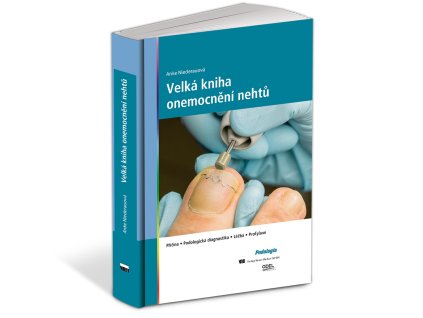 15187 1 velka kniha onemocneni nehtu