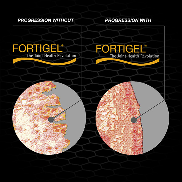 FORTIGEL®