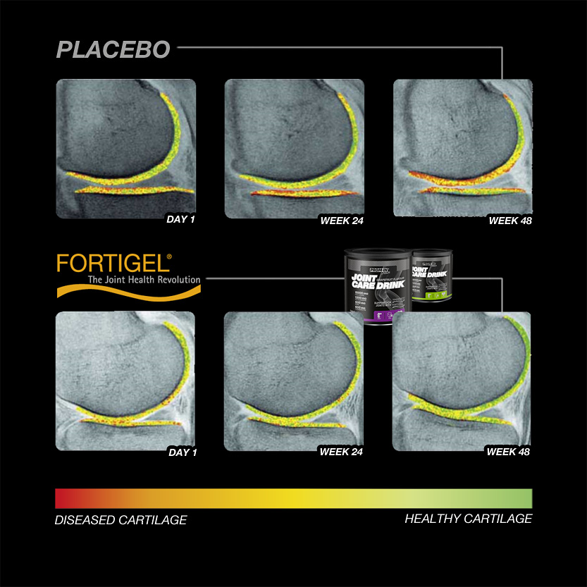 PlaceboXFortigel