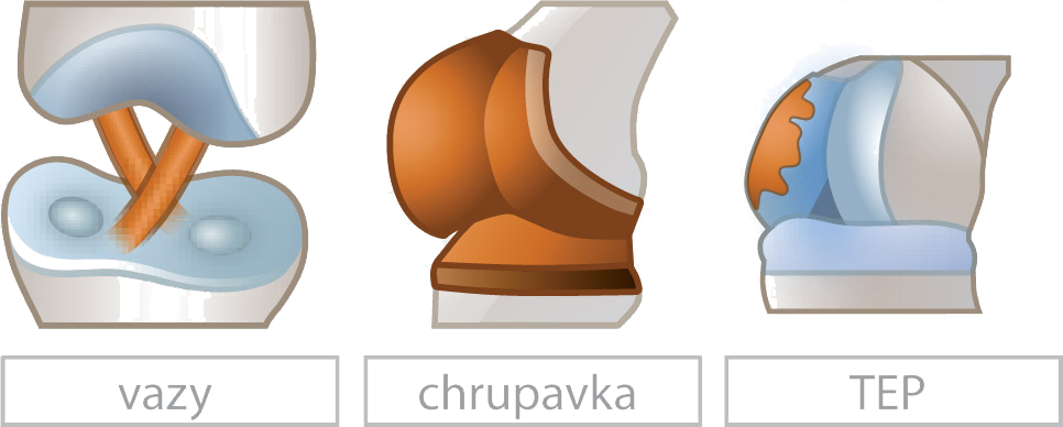 Piktogramy léčebných protokolů ARTROMOT Active-K: vazy, chrupavka, TEP